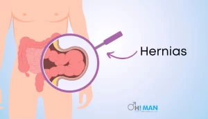 Hernias causes pain in testicles