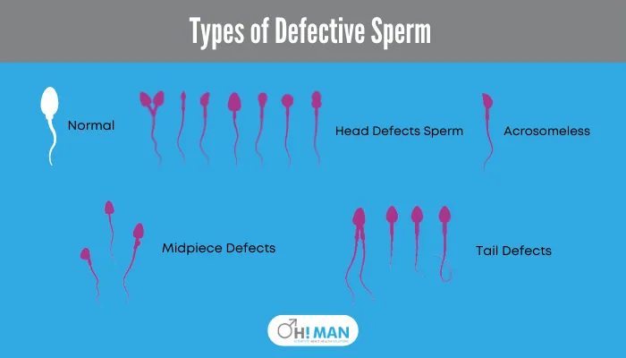 Types of Defective Sperm