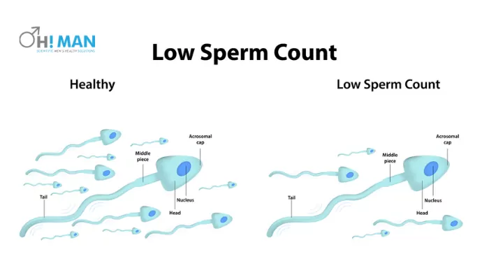ART is one of the most widely used Low sperm count treatment which is suggested by doctors 